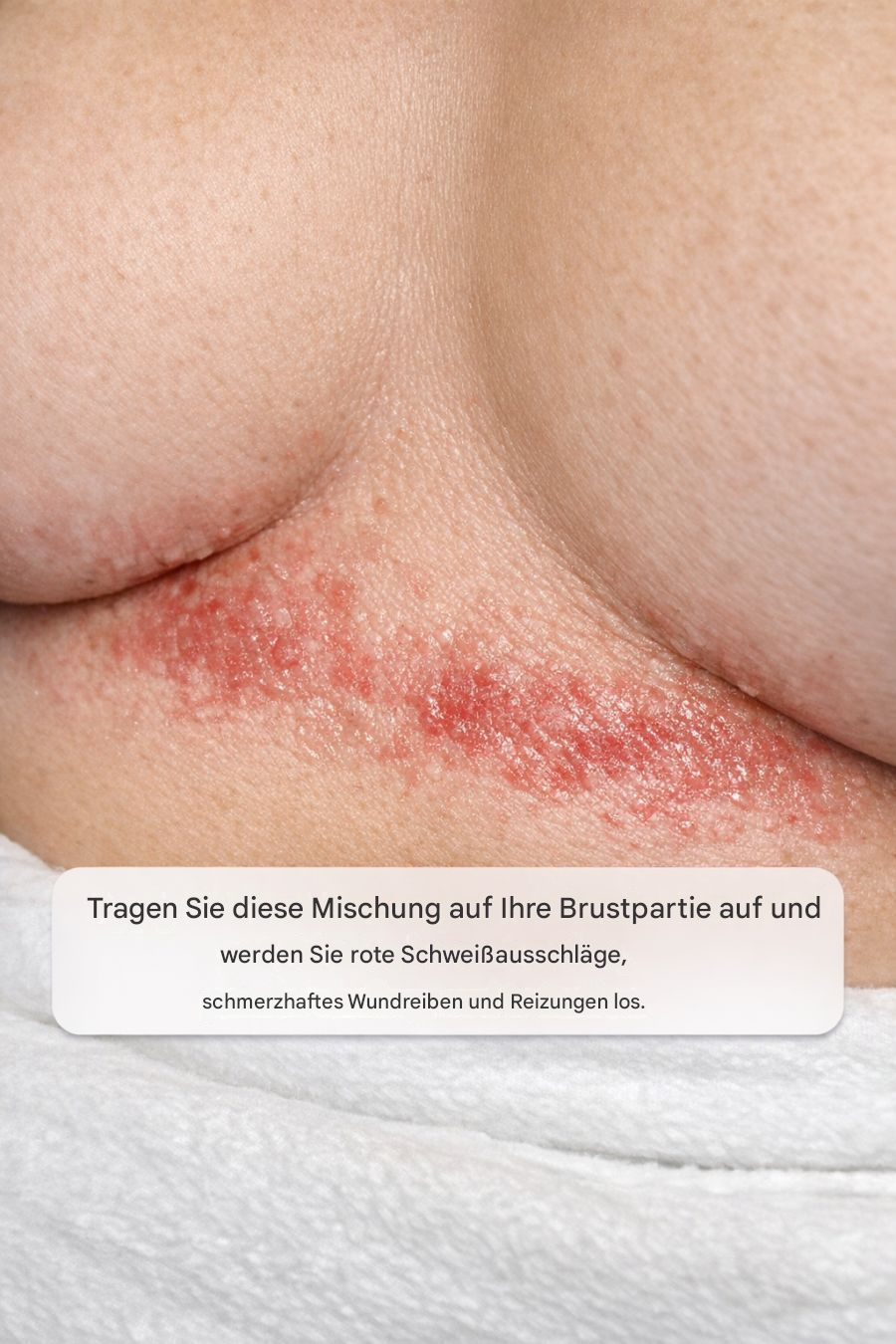 Tragen Sie diese Mischung auf Ihre Brustpartie auf und werden Sie rote Schweißausschläge, schmerzhaftes Wundreiben und Reizungen los.