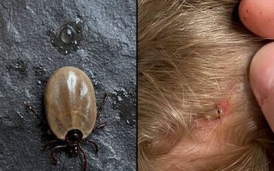 Weiß jemand, um welche Insektenart es sich handelt? Ich habe es auf dem Kopf meines Sohnes gefunden…