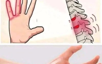 Taubheitsgefühl oder Kribbeln in den Händen? Diese 10 unerwarteten Ursachen sollten Sie alarmieren.