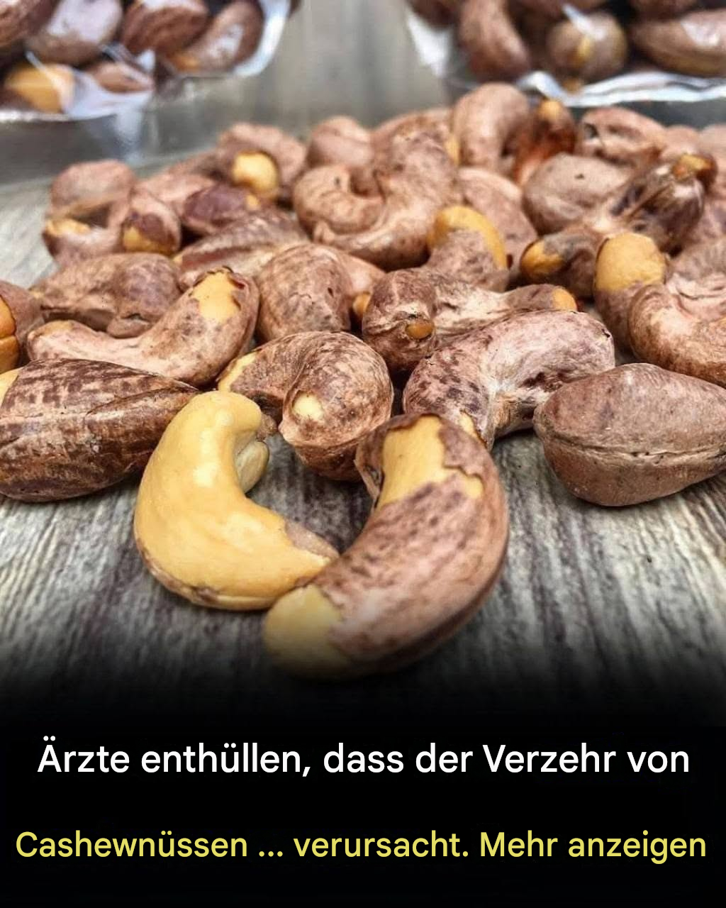 Ärzte enthüllen, was passiert, wenn man regelmäßig Cashewnüsse isst.