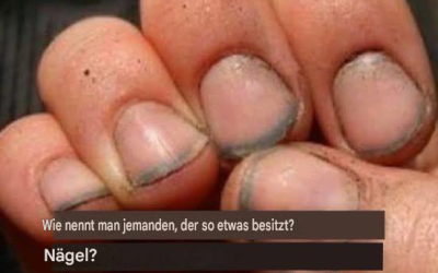 Wie nennt man jemanden mit solchen Nägeln?