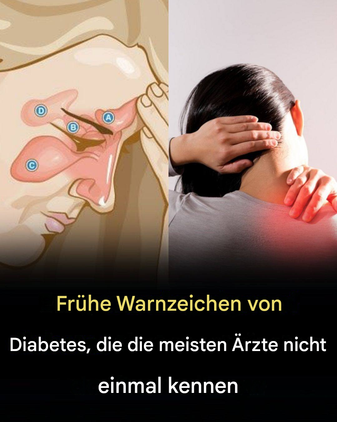 9 heimtückische Frühsymptome von Diabetes, die Sie möglicherweise übersehen