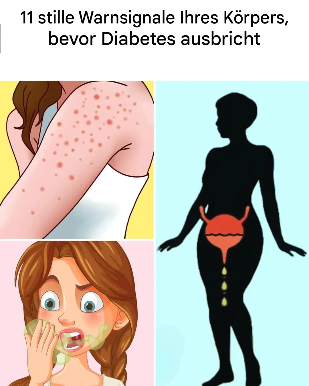 11 subtile Warnsignale Ihres Körpers vor dem Ausbruch von Diabetes