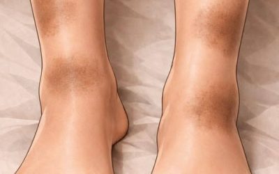 Das sind die Folgen des Zusammenschlafens mit… weiterlesen
