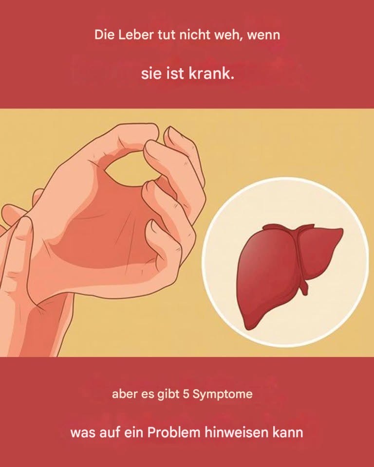 Eine Lebererkrankung verursacht keine Schmerzen, aber es gibt 5 Symptome, die auf ein Leberproblem hinweisen können.