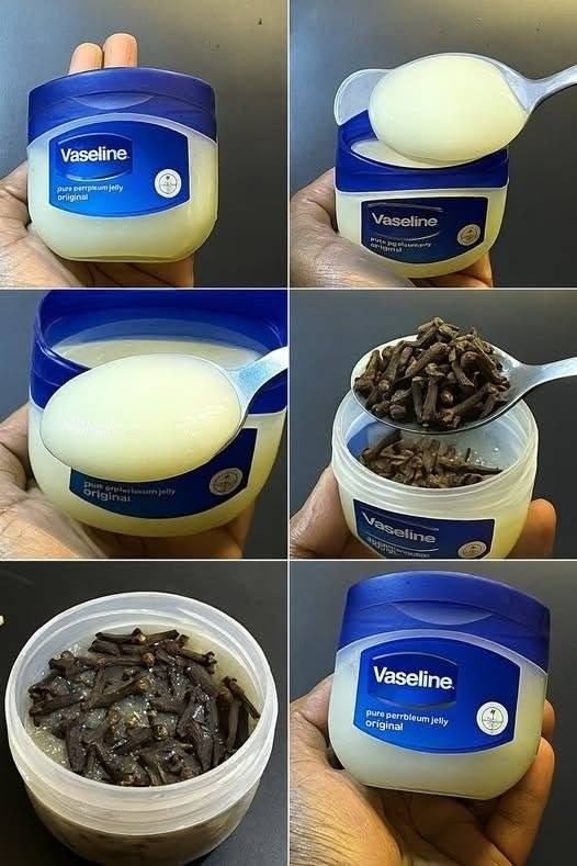 Nelken mit Vaseline mischen: ein Geheimnis, das dir niemand verraten wird. Danke mir später.