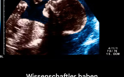 Wissenschaftler haben möglicherweise eine der Ursachen von Autismus entdeckt.