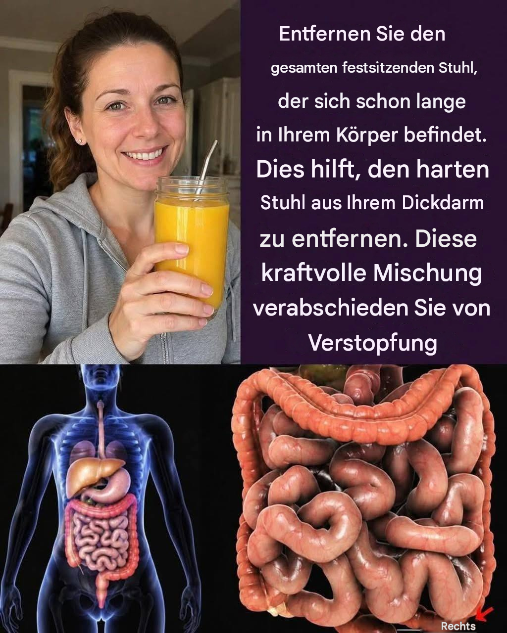 Befreien Sie sich von hartnäckigen Verstopfungen, die sich schon lange in Ihrem Körper festgesetzt haben. Selbst Kaugummi aus der Kindergartenzeit wird damit verschwinden. Mit dieser kraftvollen Mischung gehören Verstopfung und Verstopfung der Vergangenheit an. Hier ist das Rezept für ein einfaches „OK“.