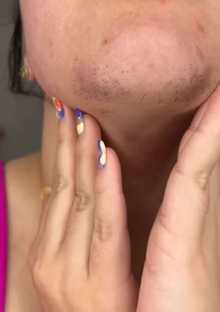 Damen, aufgepasst! Darum wachsen mit dem Alter häufiger Haare am Kinn