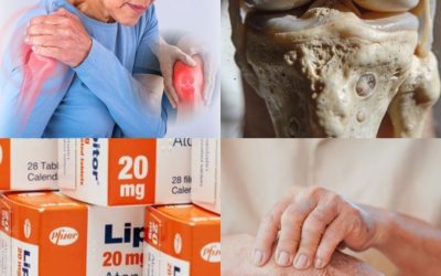 Dies sind die ersten Symptome von Osteoporose… Mehr anzeigen