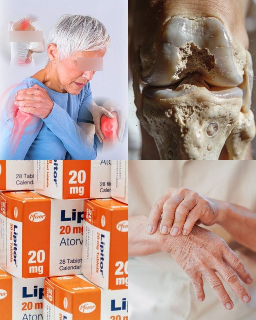 Dies sind die ersten Symptome von Osteoporose… Mehr anzeigen