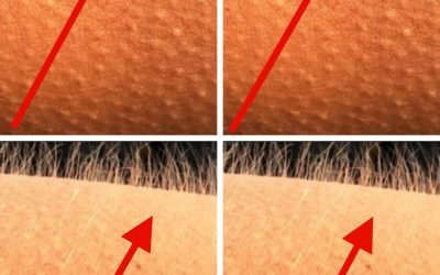 Dies sind die ersten Symptome einer… Mehr anzeigen