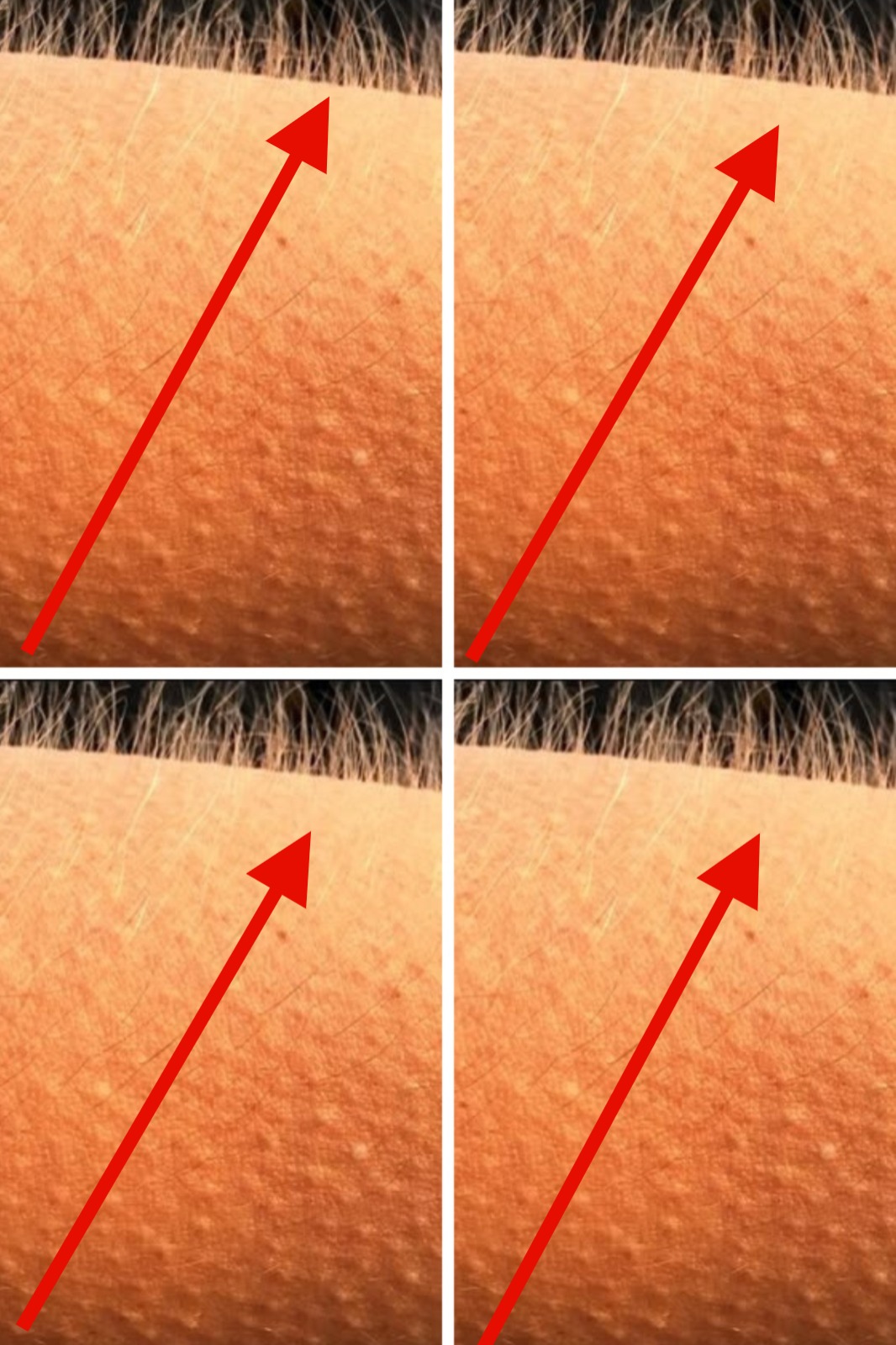 Dies sind die ersten Symptome einer… Mehr anzeigen