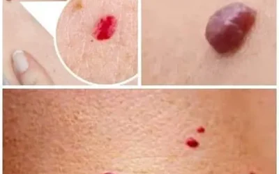 Kleine rote Flecken auf der Haut: Was Ihr Körper Ihnen wirklich sagen will
