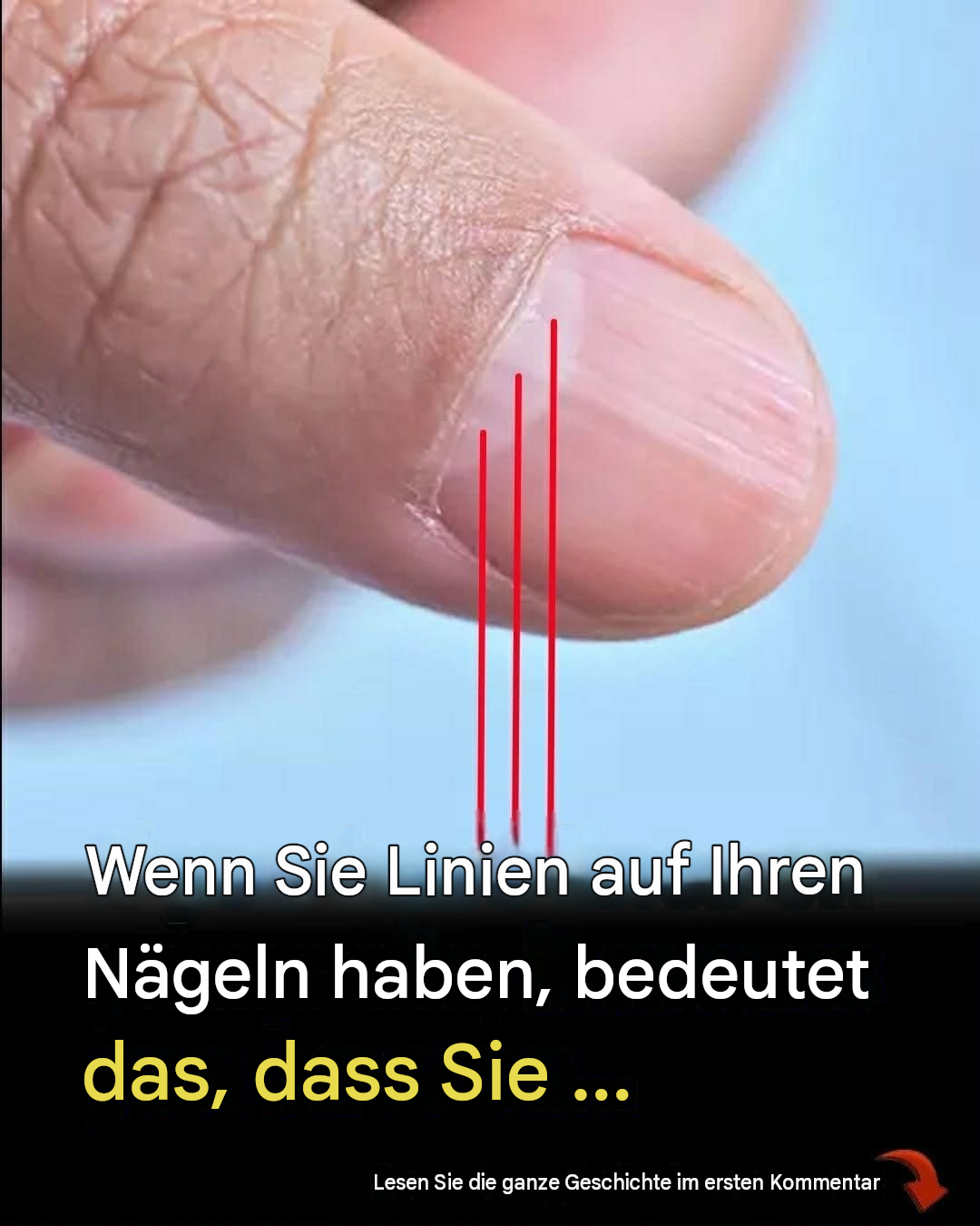 Ein Arzt entdeckt ein verräterisches Zeichen in Ihren Fingernägeln, das Ihre Lebenserwartung vorhersagen könnte.
