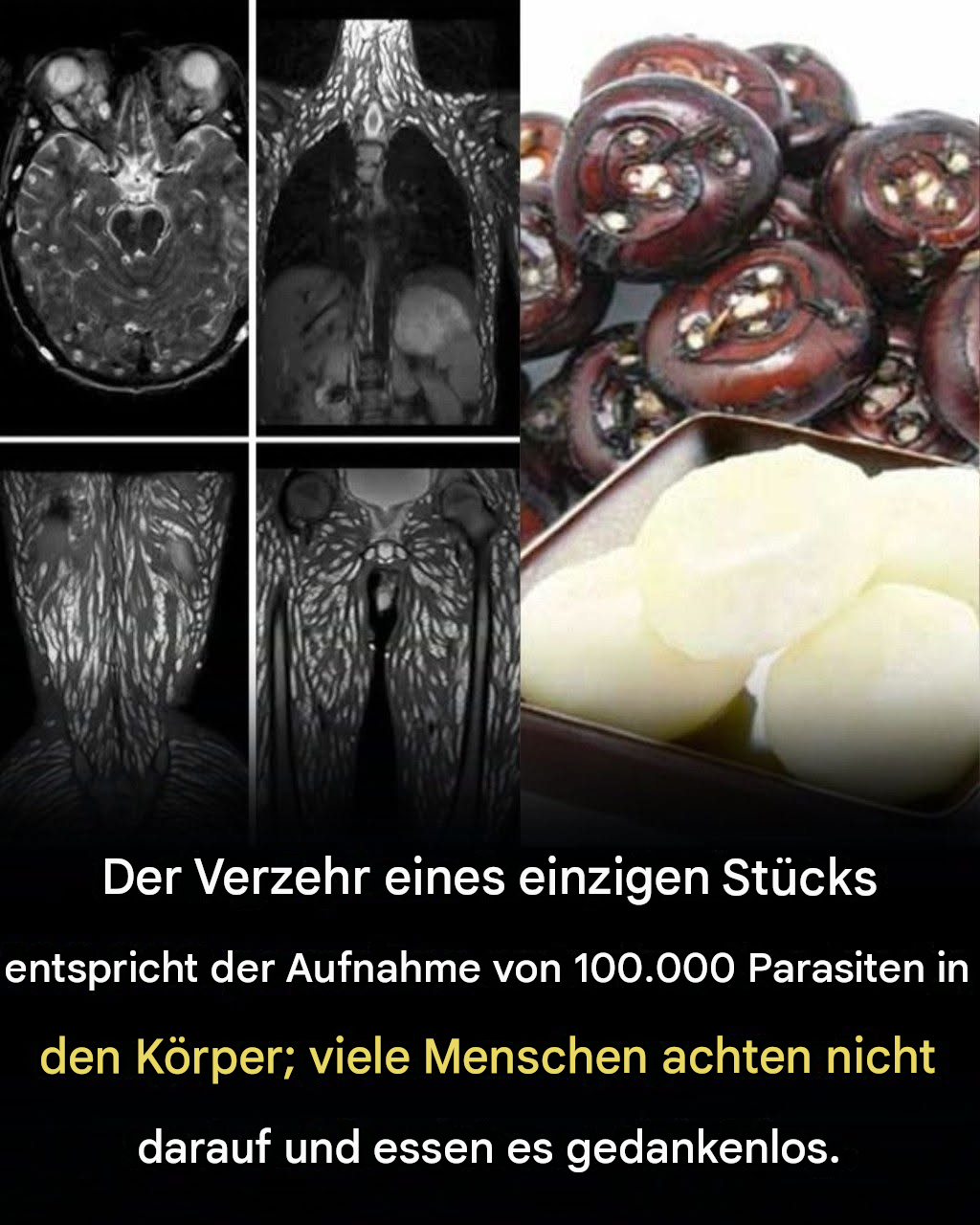 Schon ein einziger Bissen kann schädlich sein: So schützen Sie sich vor lebensmittelbedingten Parasiten
