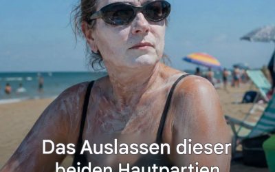 Diese beiden Stellen werden immer wieder vergessen, aber man sollte sie unbedingt mit Sonnencreme eincremen!