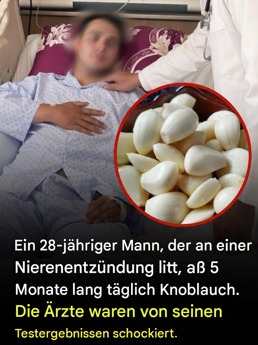 Er aß fünf Monate lang täglich Knoblauch: Hier sind die Erkenntnisse der Ärzte über seine Nieren.